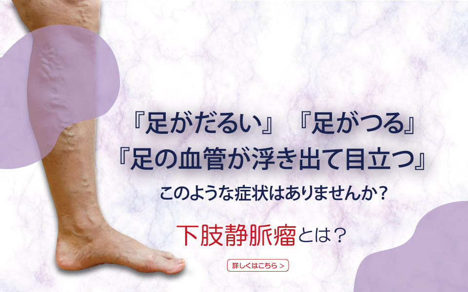 下肢静脈瘤