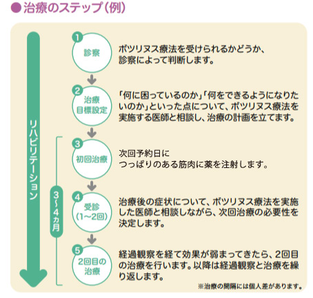 ボツリヌス療法の治療