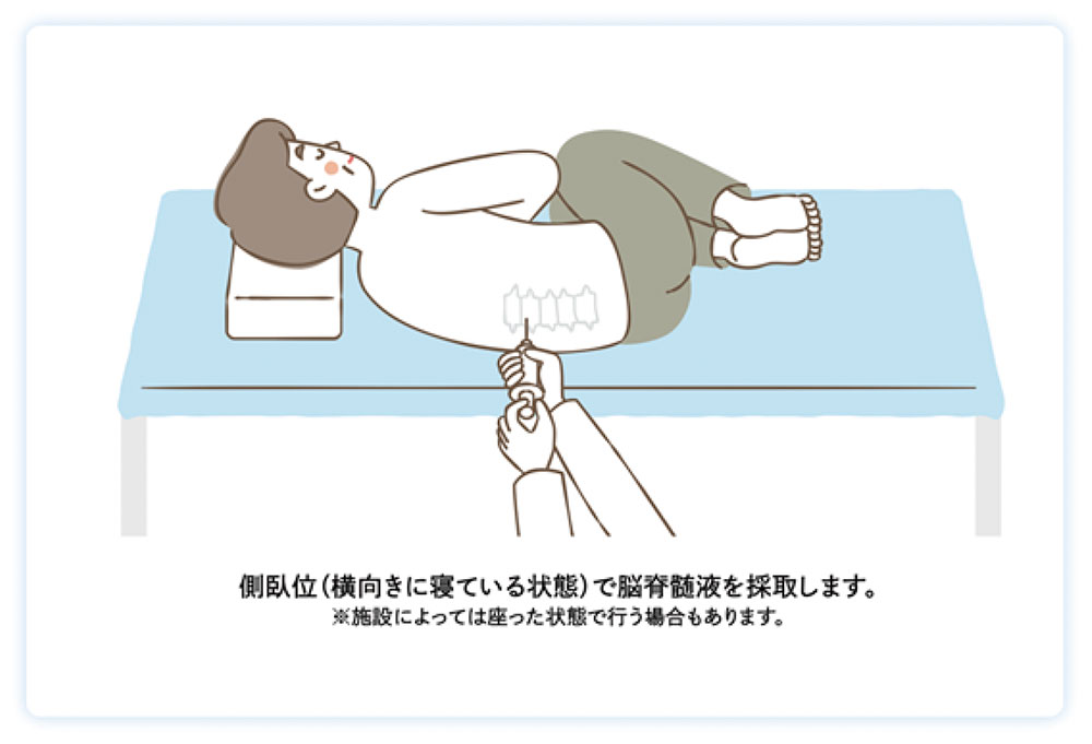 腰椎穿刺による髄液検査